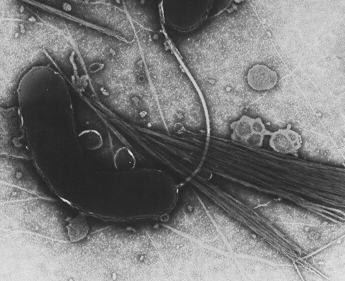Vi khuẩn Vibrio cholerae dưới kính hiển vi điện tử, tác nhân gây bệnh tả.